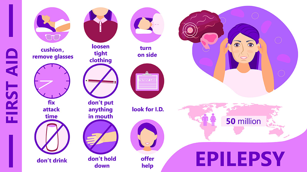 What to do when a child has a seizure epilepsy guide for parents